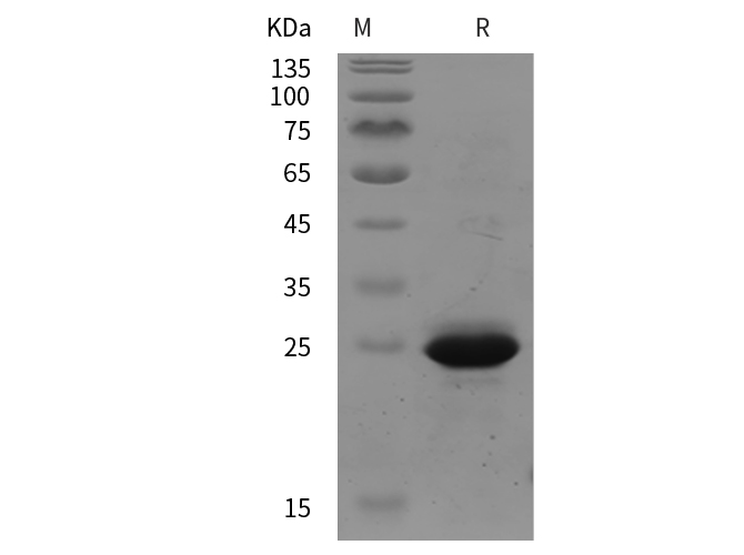 Recombinant Human IL-33 Protein(TRX Tag)-产品推荐-1
