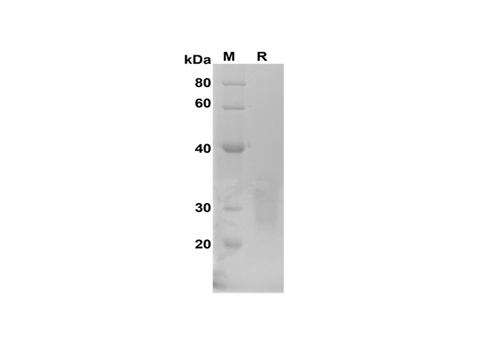 Recombinant Mouse IL-1 beta/IL1B Protein-产品推荐-4