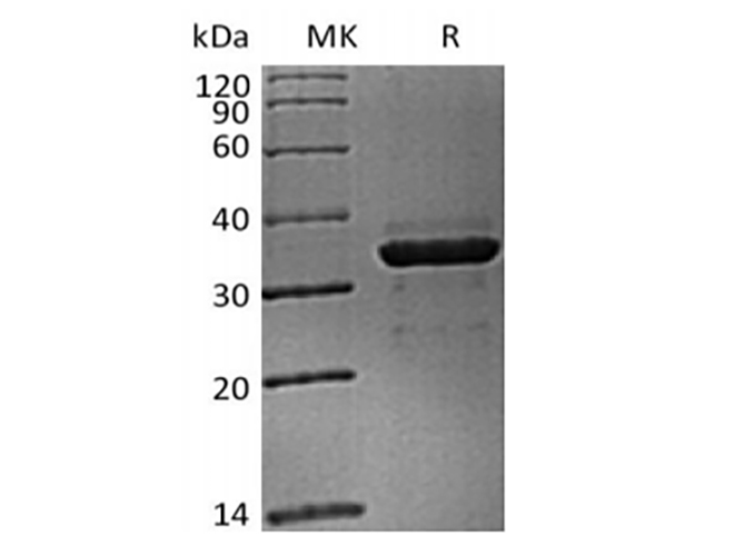 Loaded Cynomolgus LAG-3-Fc(Cat#PKSQ050015) on Protein A Biosensor, can bind Cynomolgus FGL1-His(Cat#PKSQ050095) with an affinity constant of 28.6nM as determined in BLI assay.