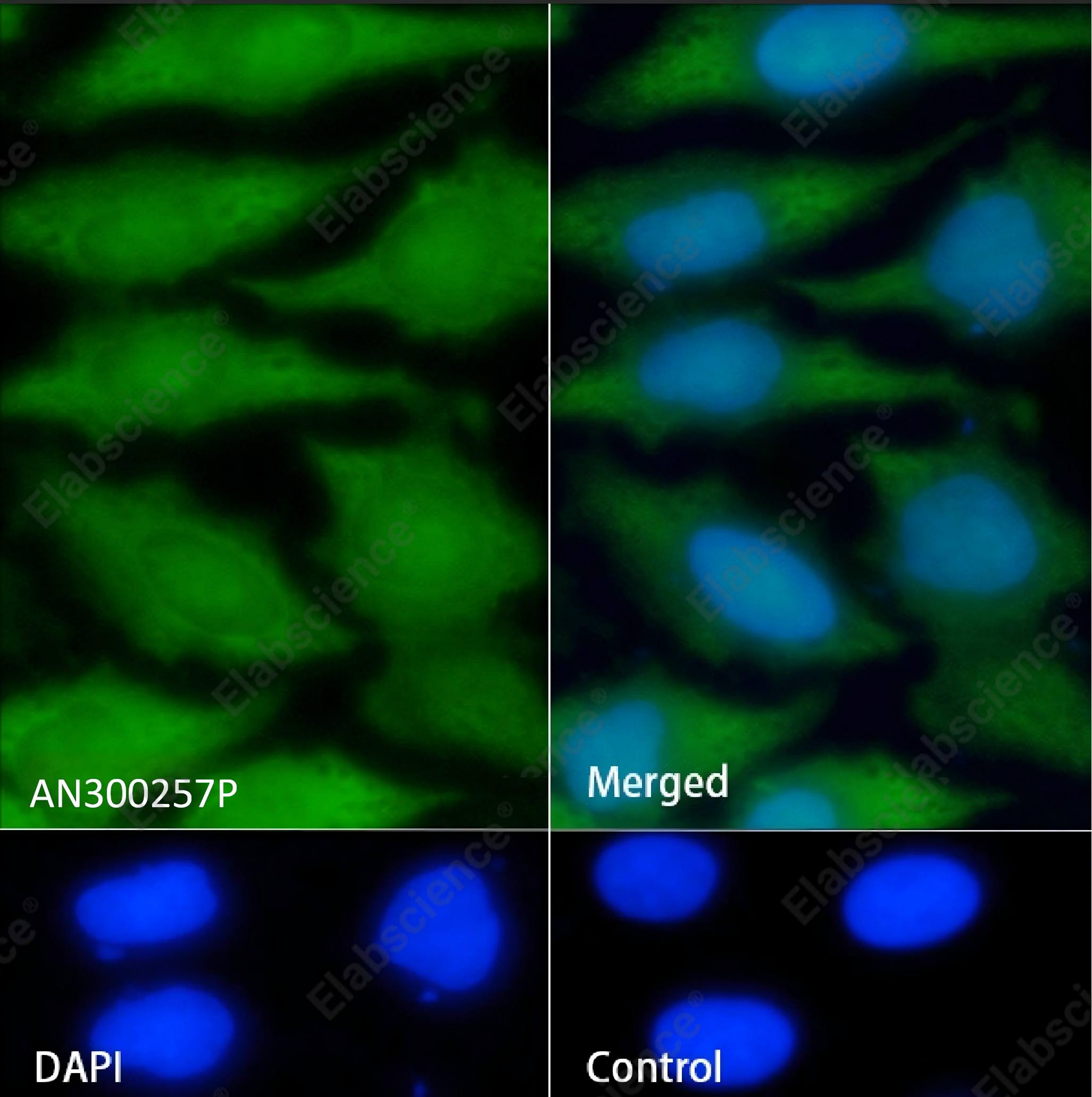 Recombinant PARK7/DJ-1 Monoclonal Antibody - 2