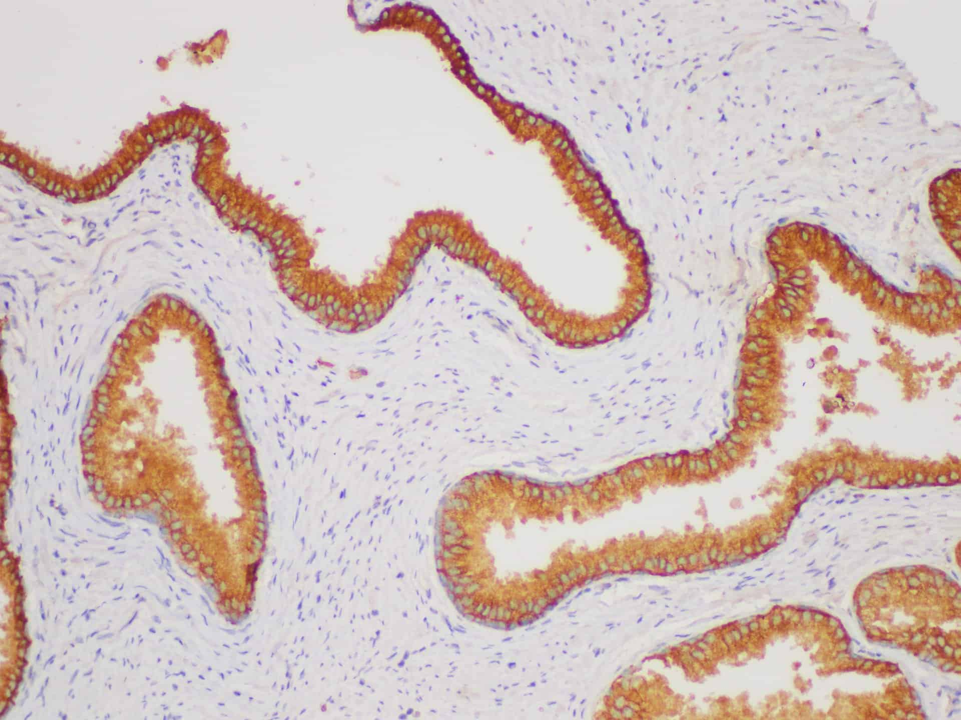 Immunohistochemistry of paraffin-embedded Human prostate using CD38 Polycloanl Antibody at dilution of 1:200