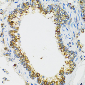 Immunohistochemistry of paraffin-embedded Rat lung using PI3 Polyclonal Antibody at dilution of 1:100 (40x lens).