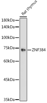 Western blot analysis of extracts of Rat thymus using ZNF384 Polyclonal Antibody at 1:1000 dilution.