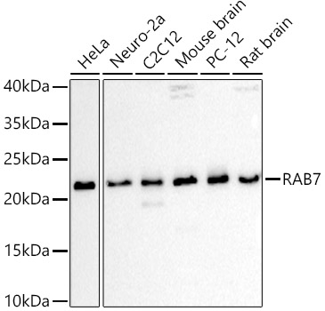 Western blot analysis of extracts of various cell lines using RAB7 Polyclonal Antibody at 1:1000 dilution.