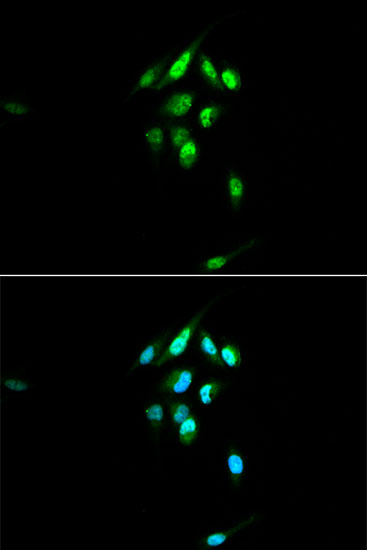 Immunofluorescence analysis of U2OS cells using NR3C1 Polyclonal Antibody at dilution of 1:100. Blue: DAPI for nuclear staining.