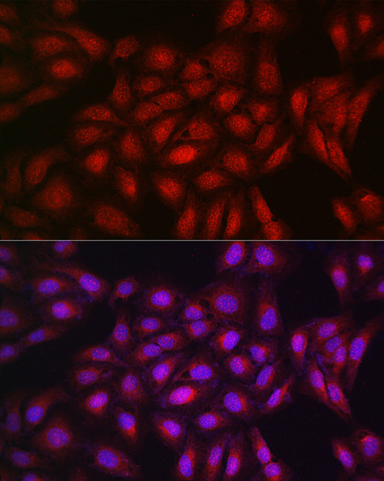 Immunofluorescence analysis of U2OS cells using PPARγ Polyclonal antibody at dilution of 1:200 (40x lens). Blue:DAPI for nuclear staining.