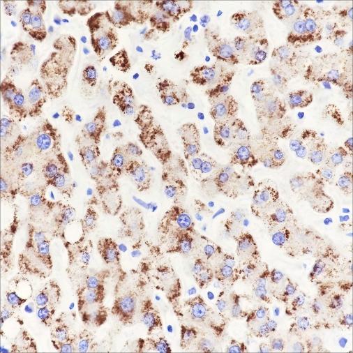 Recombinant AMACR Monoclonal Antibody - small - 4