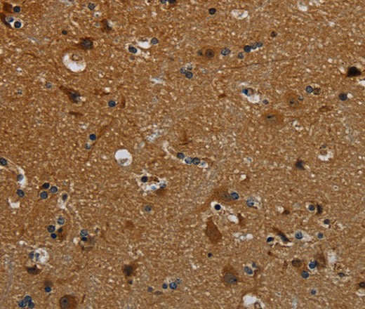 Immunohistochemistry of paraffin-embedded Human brain tissue using PCDHB15 Polyclonal Antibody at dilution 1:50