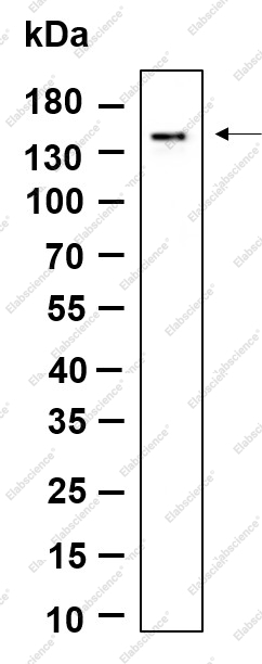 Recombinant MDA5 Monoclonal Antibody - 1