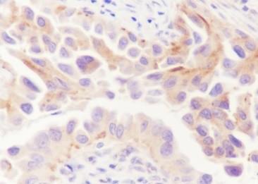 Recombinant ATG9A Monoclonal Antibody-searchlist-2
