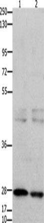 Western Blot analysis of 231 cell and Mouse testis tissue using GNRHR Polyclonal Antibody at dilution of 1:650