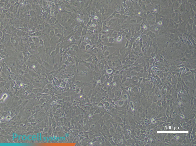 Mouse Scleral FibroblastsMouse Scleral Fibroblasts - 3