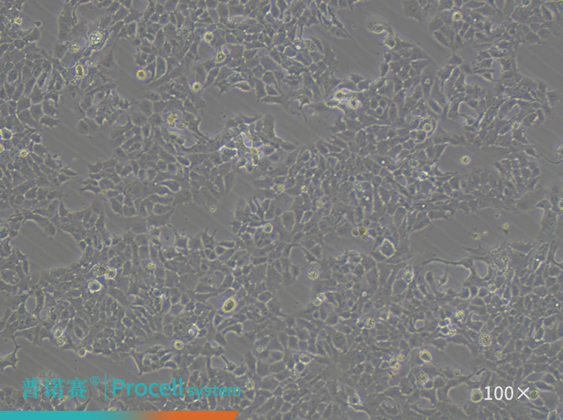 NCI-H322（人支气管肺腺癌细胞）-细胞系-武汉普诺赛生命科技有限公司