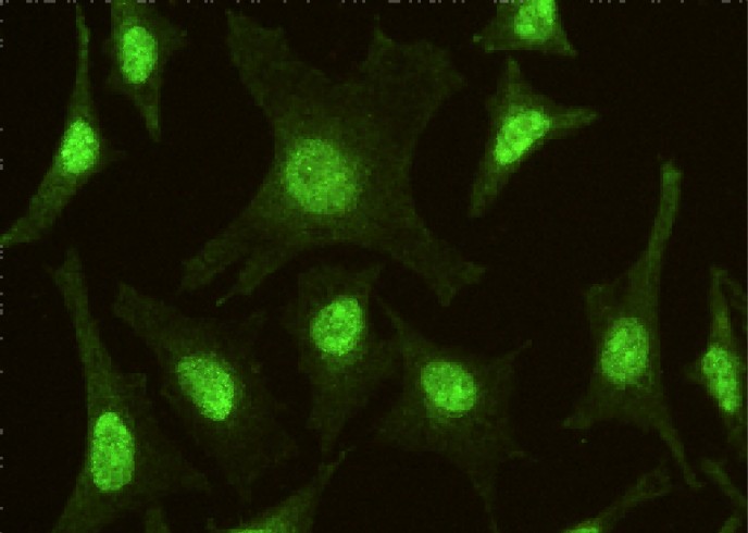 IRF6 Monoclonal Antibody-searchlist-1