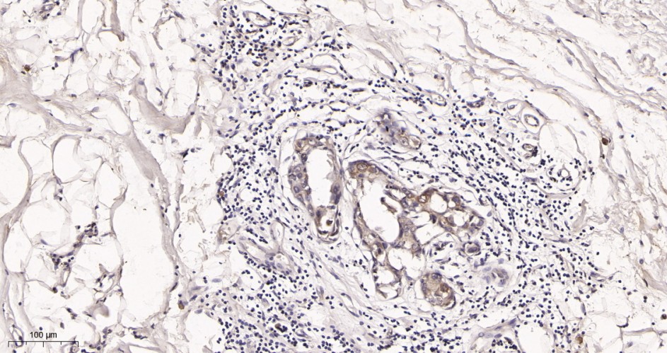 Recombinant EEA1 Monoclonal Antibody - small - 2