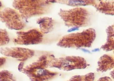 Recombinant MYH7 Monoclonal Antibody-searchlist-1