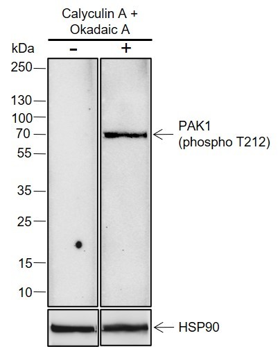 Recombinant Phospho-PAK1 (Thr212) Monoclonal Antibody-searchlist-1