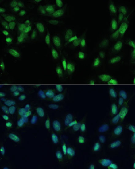Immunofluorescence analysis of U2OS cells using SMAD7 Polyclonal Antibody at dilution of 1:100. Blue: DAPI for nuclear staining.