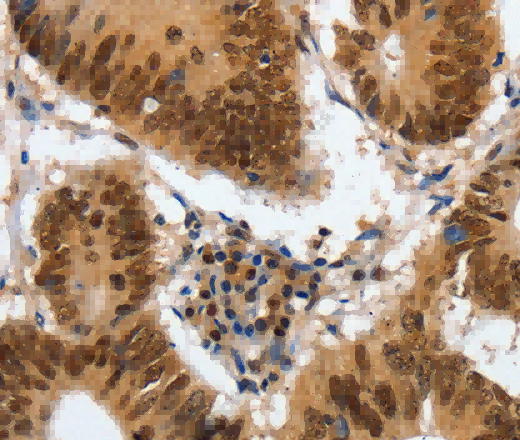 COPS5 Polyclonal Antibody - 2