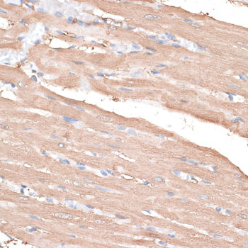 Immunohistochemistry of paraffin-embedded Rat heart using KIF14 Polyclonal Antibody at dilution of  1:100 (40x lens).