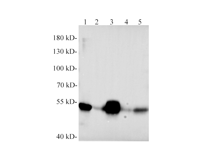 Western blotting with anti-Desmin polyclonal Antibody at dilution of 1:1000. Lane 1: C2C12 cell lysates, lane 2: Mouse heart lysate, lane 3: Mouse skeletal muscle lysate, lane 4: Rat heart lysate, lane 5: Rat skeletal muscle lysate.