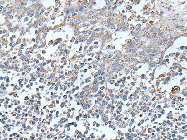 Immunohistochemistry of paraffin-embedded Human tonsil tissue  using IRF5 Polyclonal Antibody at dilution of 1:25(?200)