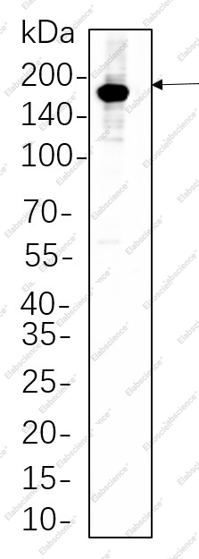 Recombinant HER2 Monoclonal Antibody - 1