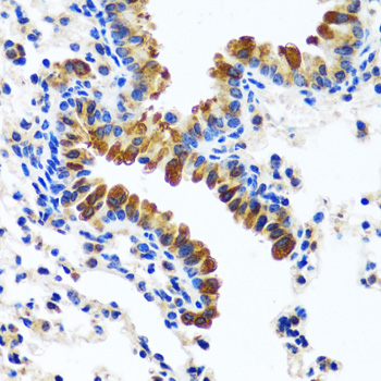 Immunohistochemistry of paraffin-embedded Mouse lung using CAMLG Polyclonal Antibody at dilution of  1:100 (40x lens).