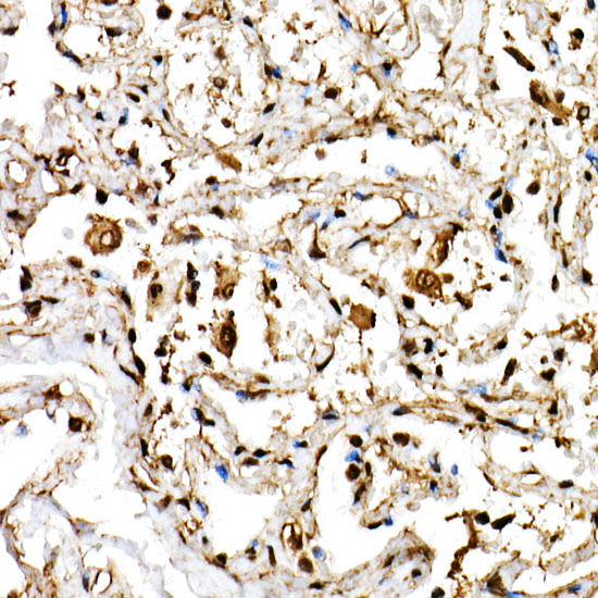 Immunohistochemistry of paraffin-embedded human lung using BHLHE40 Polyclonal Antibody at dilution of 1:150 (40x lens).Perform high pressure antigen retrieval with 10 mM citrate buffer pH 6.0 before commencing with IHC staining protocol.