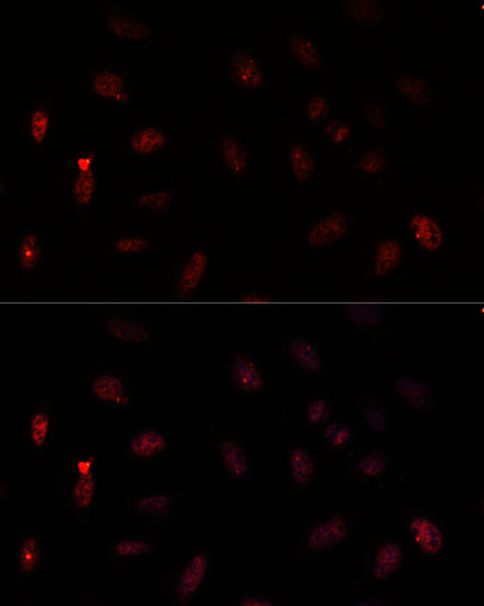 Immunofluorescence analysis of U-2 OS cells using PAX6 Polyclonal Antibody at dilution of  1:100. Blue: DAPI for nuclear staining.