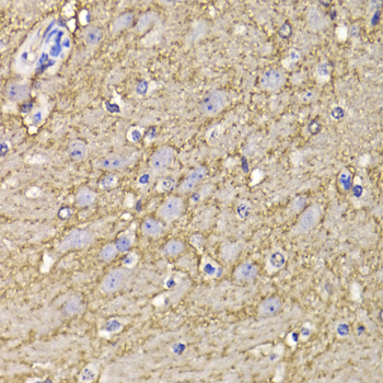 Immunohistochemistry of paraffin-embedded Mouse brain using KCND3 Polyclonal Antibody at dilution of 1:100 (40x lens).