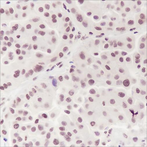 Recombinant Ataxin-3 Monoclonal Antibody-searchlist-1