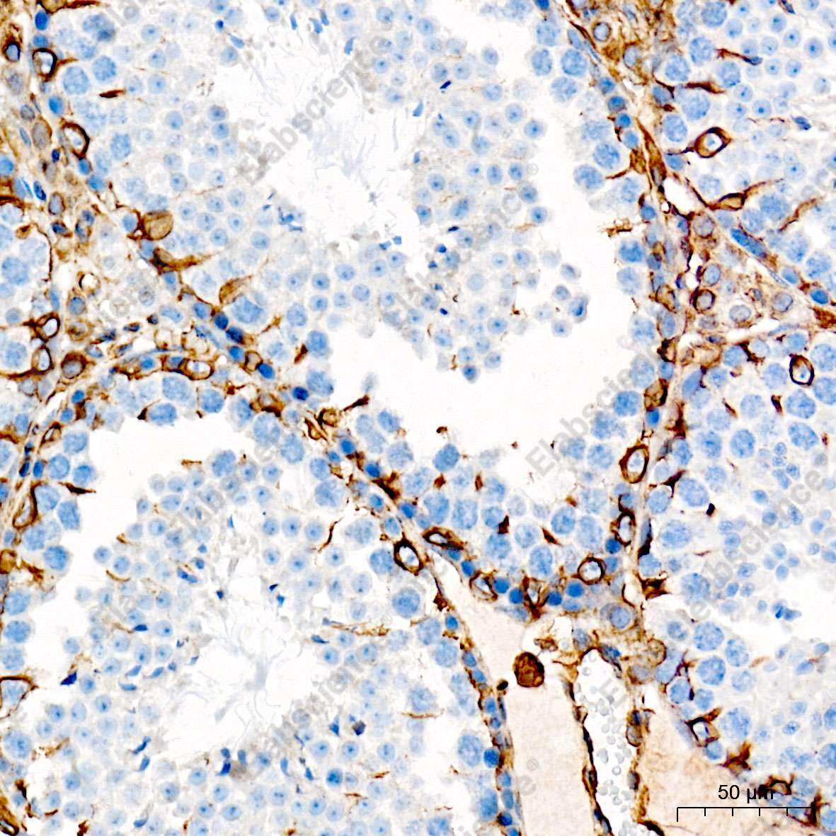 (KO Validated) Vimentin Polyclonal Antibody - 7