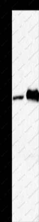 HTR1A Polyclonal Antibody - 1