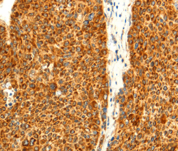 DIABLO Polyclonal Antibody - 3