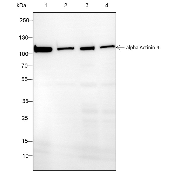 Recombinant alpha Actinin 4 Monoclonal Antibody-searchlist-1