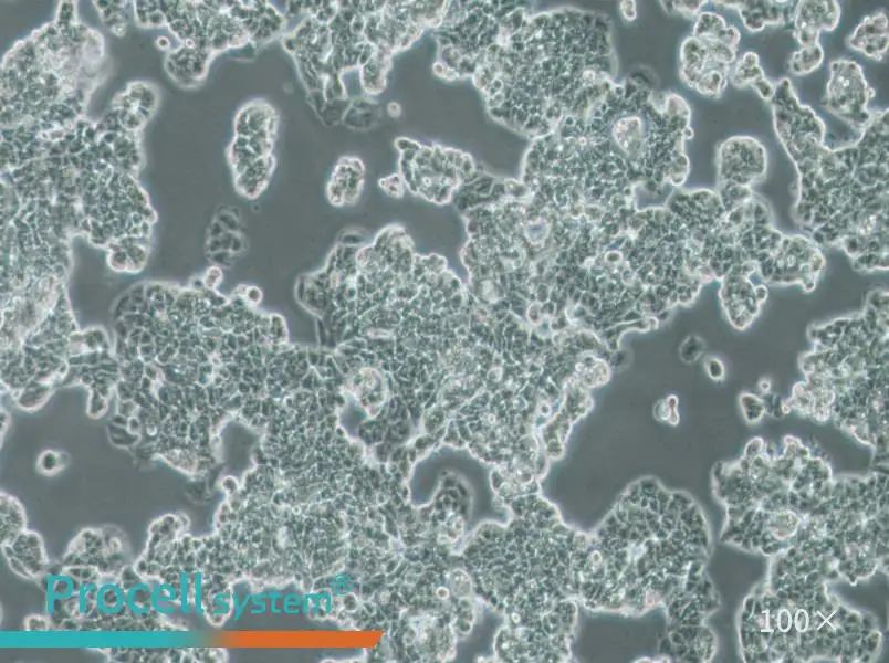 MCF7 [MCF-7] Cell Complete Medium - 2