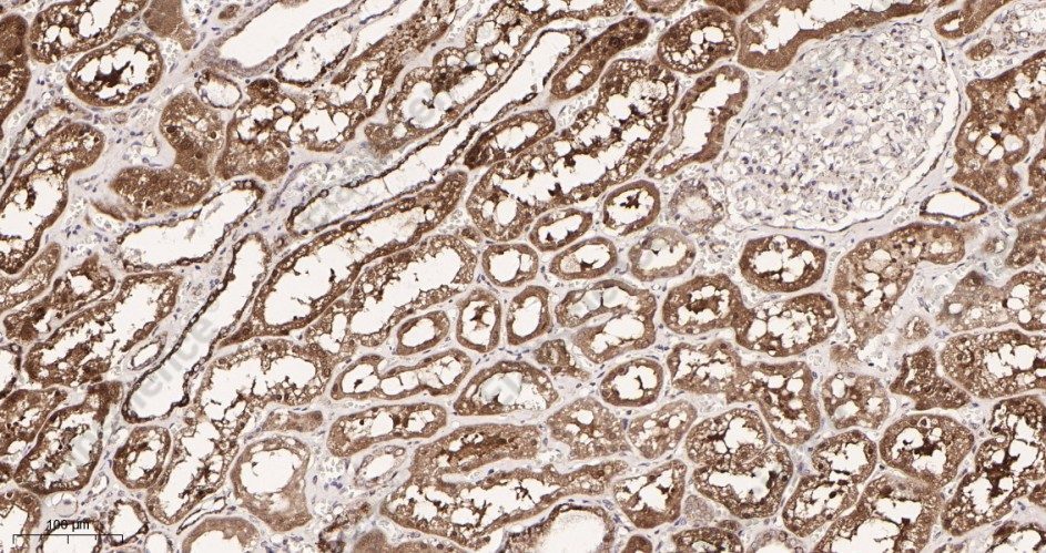 Recombinant Pyruvate Dehydrogenase E1 α Monoclonal Antibody - 2