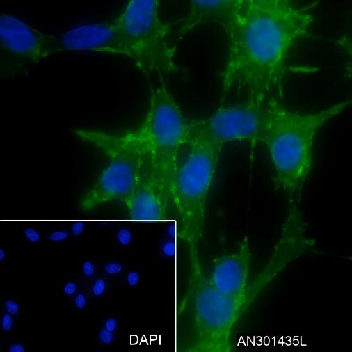 Recombinant alpha smooth muscle Actin Monoclonal Antibody - small - 7
