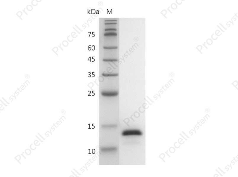 IL-2/TCGF/Aldesleukin, Human, Recombinant