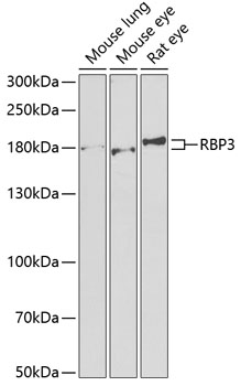 Western blot analysis of extracts of various cell lines using RBP3 Polyclonal Antibody at 1:1000 dilution.