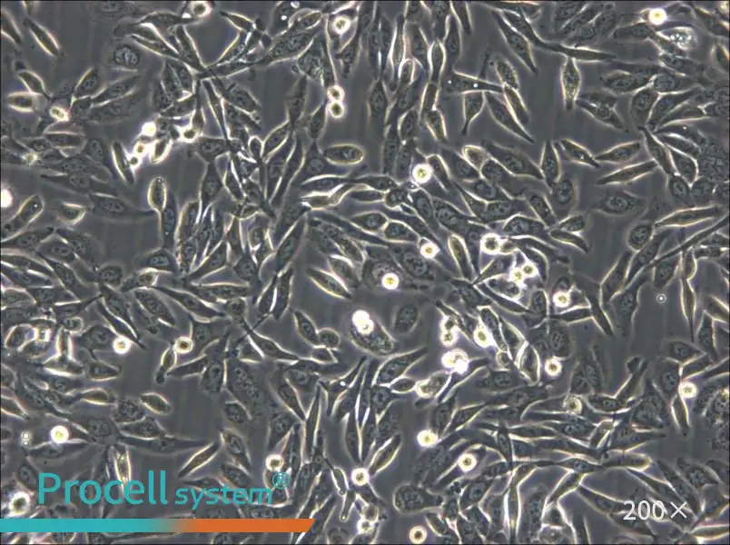 NUGC-3 Cell Complete Medium - 5