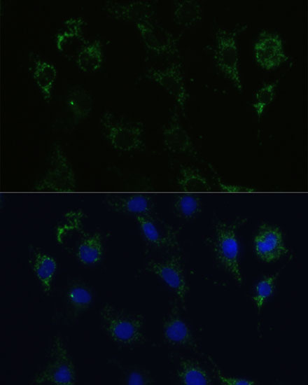 Immunofluorescence analysis of C6 cells using STX1A Polyclonal Antibody at dilution of 1:100 (40x lens). Blue: DAPI for nuclear staining.