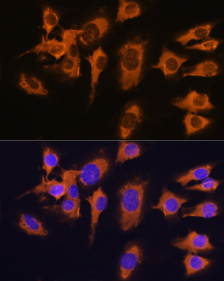 Immunofluorescence analysis of C6 cells using SLC20A1 Polyclonal Antibody at dilution of  1:100. Blue: DAPI for nuclear staining.