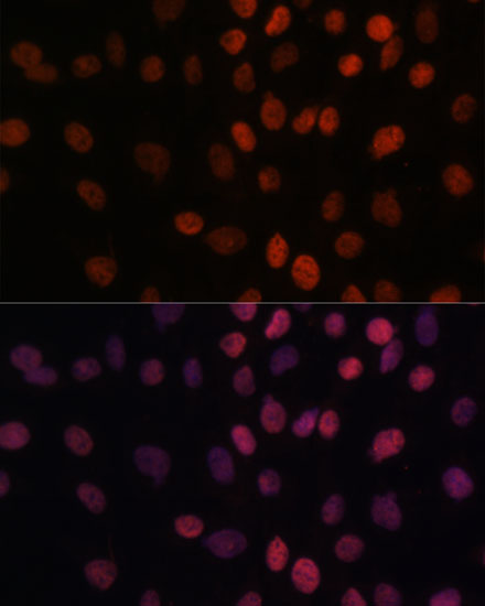 Immunofluorescence analysis of C6 cells using ARID1B Polyclonal Antibody at dilution of  1:100. Blue: DAPI for nuclear staining.