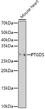 Western blot analysis of extracts of Mouse heart using PTGDS Polyclonal Antibody at 1:500 dilution.