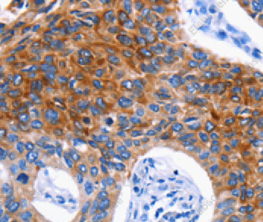 DRD4 Polyclonal Antibody - 2