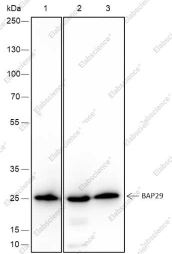 Recombinant BAP29 Monoclonal Antibody - 1