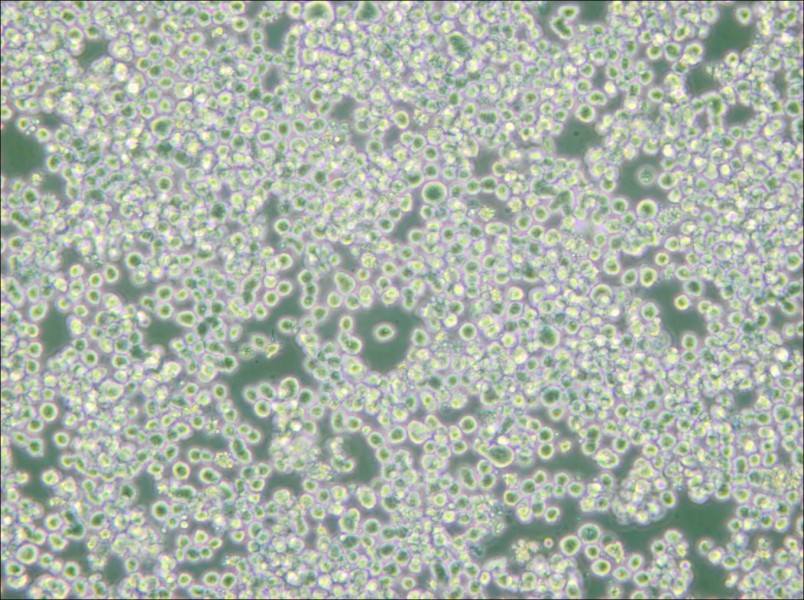 RPMI 8226 Cell Complete Medium - small - 5