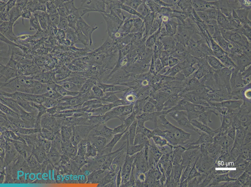 Rat Skeletal Muscle Fibroblast Complete Medium - 4